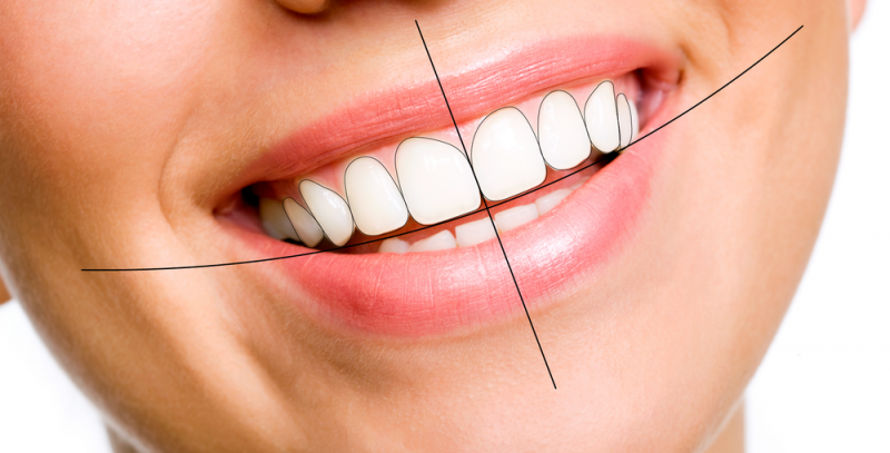 Smile Designing Services in Greater Kailash